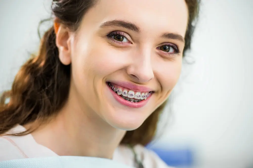 a person with metal braces smiling at the camera. braces cost in Indianapolis, IN