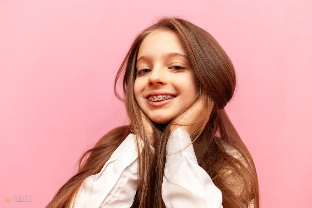A young woman smiling confidently with her hands on her face, showcasing the results of treatment for how to fix overbite in Indianapolis, IN.