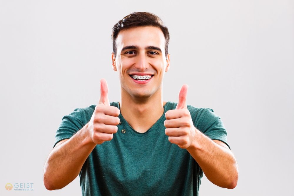 a man giving two thumbs up after being explained about how long do braces take in indianapolis, in